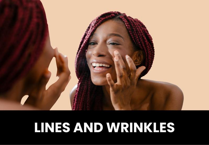 lines wrinkles treatment