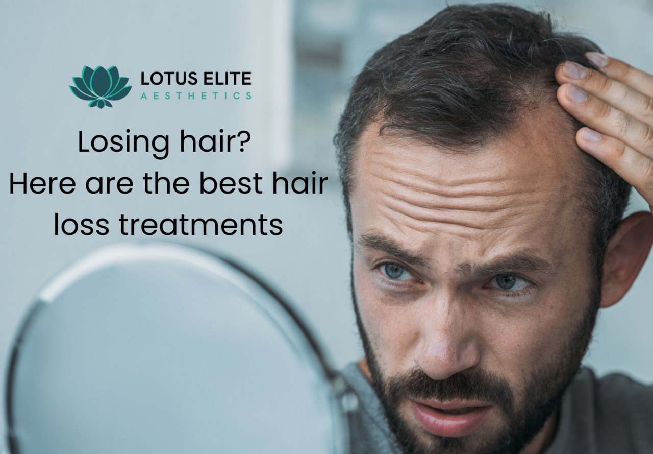 Losing hair? Here are the Best Hair Loss Treatments